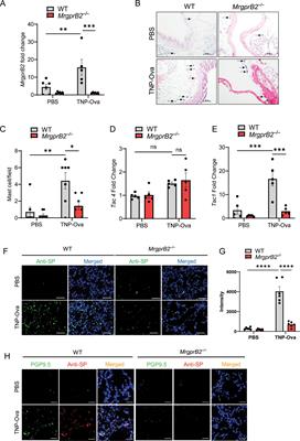 Mast cell MrgprB2 in neuroimmune interaction in IgE-mediated airway inflammation and its modulation by β-arrestin2